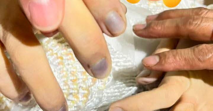 LBH Medan Menduga Kematian Winda Lorenza Gosawa Bukan Karena Bunuh Diri